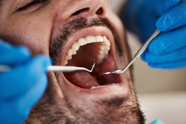 Best Chipped Tooth Repair Near Me  in Maugansville, MD
